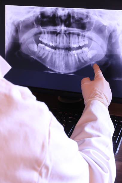 Best Urgent Care for Lost Fillings or Crowns in Lowesville, NC