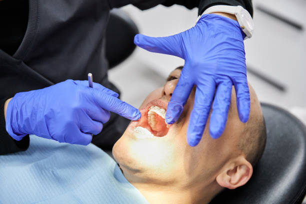 Best Emergency Wisdom Teeth Removal in Lowesville, NC