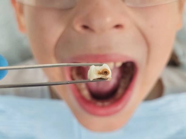 Best Cosmetic Emergency Dentistry in Lowesville, NC
